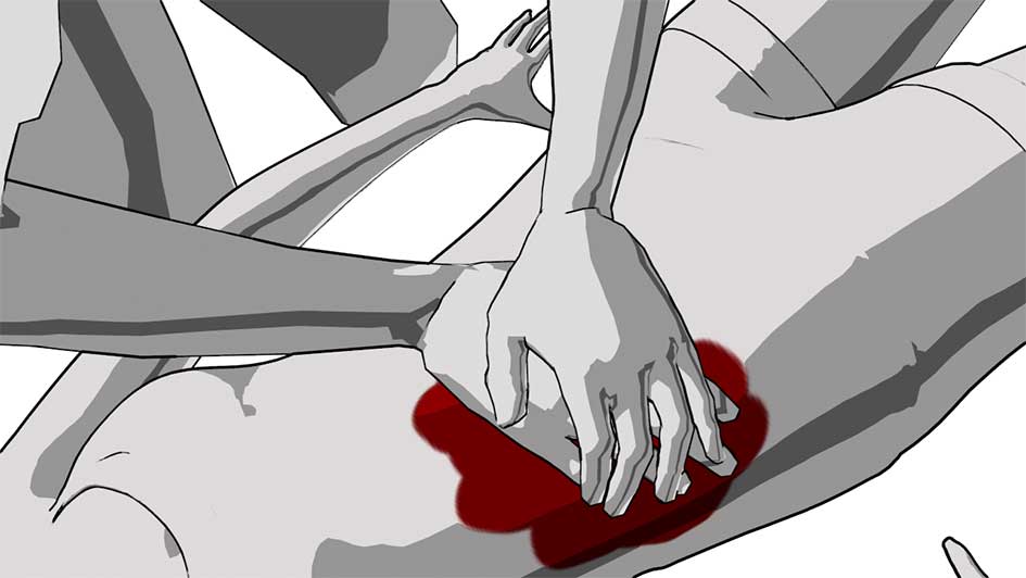 A man has a serious bleeding injury on his shoulder